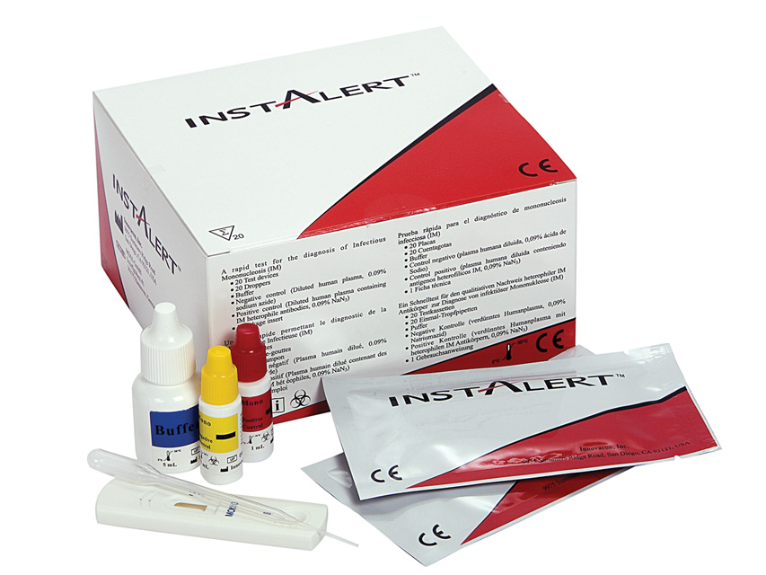 MONONUCLEOSIS TEST