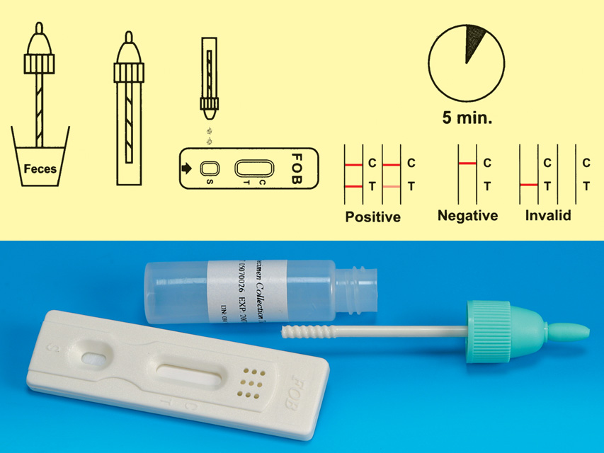 FOB TEST - occult blood in faeces