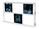 NEGATIVOSCOPE 2x3 PANELS 76 x 122 cm