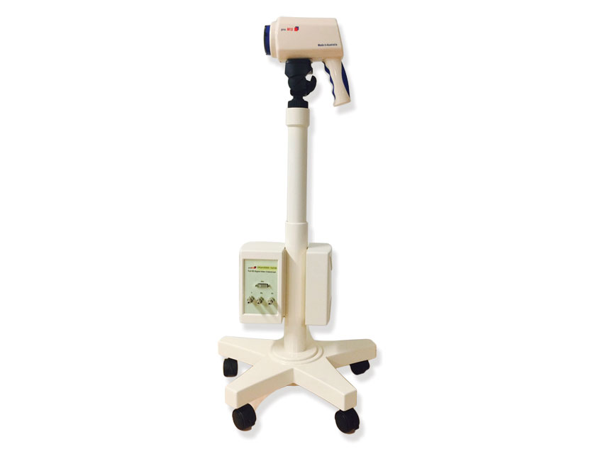 [29622] LED HD VIDEO COLPOSCOPE WITH INTEGRATED CAMERA