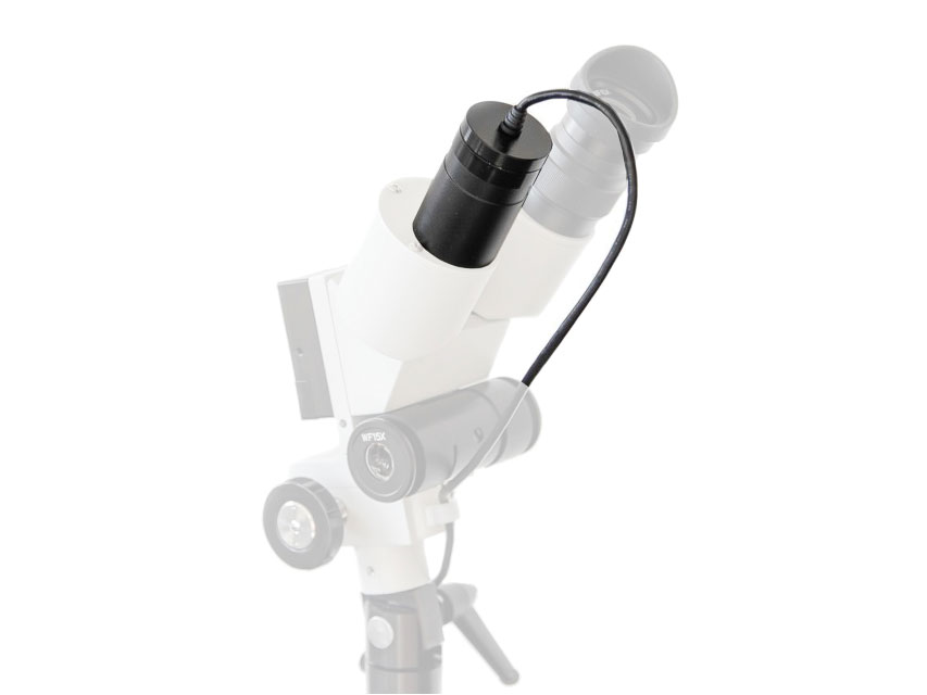 [29603] USB COLPOSCOPE CAMERA