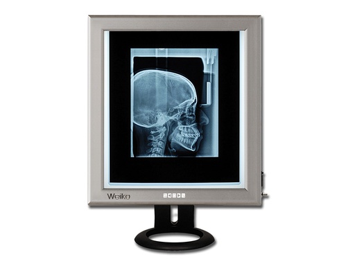[GM-30228] NEGATIVOSCOPE ULTRAPIATTO LED TABLE SCREEN - 42x36 cm